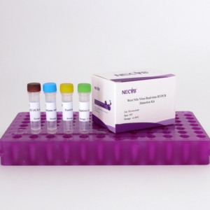 Độ nhạy cao huỳnh quang RT-PCR Kit cho Tây <span class=keywords><strong>Nile</strong></span> sốt virus phát hiện - Product Image 1