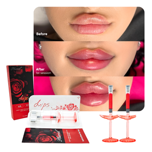 Plurvel - Remplisseur de lèvres rouge coréen - <span class=keywords><strong>Acide</strong></span> <span class=keywords><strong>hyaluronique</strong></span> - Remplisseur dermique injectable pour lèvres - 24 mg/ml - <span class=keywords><strong>Augmentation</strong></span> des lèvres - Créez des lèvres rosées - Product Image 1