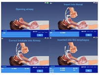Mannequin de simulation de gestion des voies respiratoires sans fil multifonctionnel pour intubation trachéale, avec masque laryngé, aspiration et simulation vocale, taille humaine