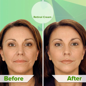Crème Anti-âge à la <span class=keywords><strong>vitamine</strong></span> C, lotion naturelle Anti-rides, hydratant, <span class=keywords><strong>Retinol</strong></span>, pour le visage, illuminant la peau - Product Image 5