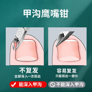 Yangzhou Pedicure Knife Set High Manganese Steel Professional Callus Remover Nail Trimmer Ingrown Toenail Tool With Case - Product Image 5