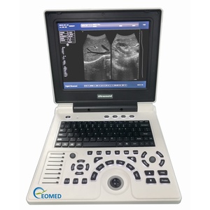 Système de diagnostic numérique par échographie portable avec écran couleur et 2 connecteurs de sondes pour usage vétérinaire BW30B - Product Image 2