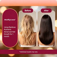 Vitamines pour la croissance des cheveux OEM/ODM pour femmes avec biotine, collagène, palmier nain, pour des cheveux plus forts et plus sains, et des ongles et une peau plus robustes