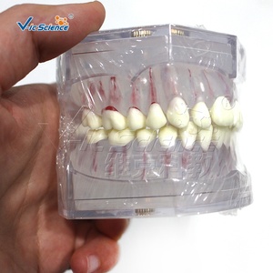Modèle dentaire standard blanc complet avec arrangement et occlusion dentaires réalistes - Product Image 2
