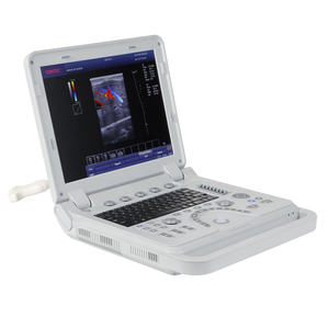 CONTEC CMS1700B <span class=keywords><strong>Color</strong></span> <span class=keywords><strong>Doppler</strong></span> 3D <span class=keywords><strong>4D</strong></span> Ultrasonik Pemindai Diagnostik Portabel Rumah Sakit - Product Image 2