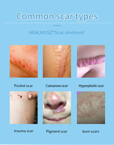 Crema Anti-Acne Rapida HEALMUSZ, <span class=keywords><strong>Trattamento</strong></span> Anti-Macchie, Crema per Rimozione Cicatrici, Riparazione Smagliature, <span class=keywords><strong>Trattamento</strong></span> Acne - Product Image 6