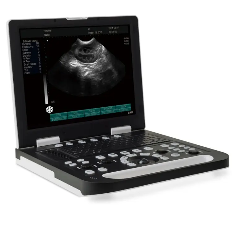 Instruments médicaux Ruisheng N50 d'ultrason de scanner portatif d'ultrason