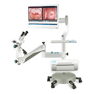 Fabricante clínico portátil máquina de colposcopia de mano cámara de vídeo portátil colposcopio óptico portátil para Ginecología - Product Image 1