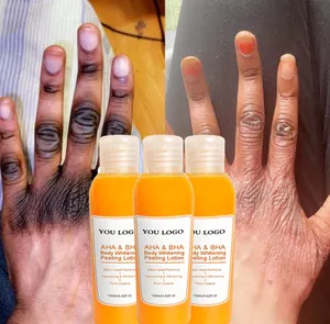 Most Effective AHA BHA body peeling lotion knuckles removing dead skin whitening organic orange peeling lotion