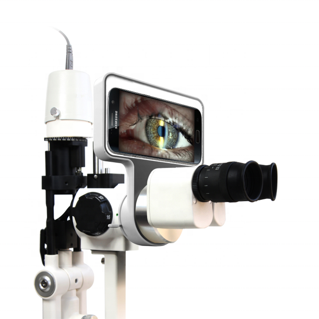 Ophthalmic Equipment Slit Lamp Digital Camera Module Works With Android Phones and IPhones
