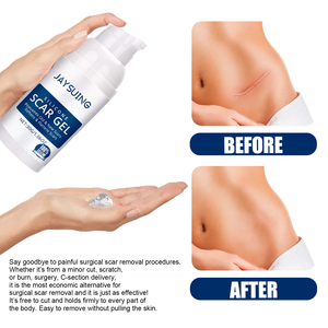 Crème gel <span class=keywords><strong>silicone</strong></span> réparatrice, raffermissante, lissante et hydratante pour les cicatrices JAYSUING - Product Image 5