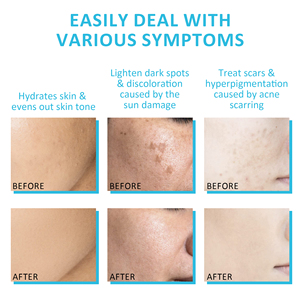 <span class=keywords><strong>Titok</strong></span> Venta caliente Brightening Dark Spot Facial Skin Lighting Niacinamide Face Serum - Product Image 6