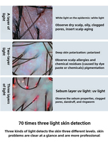 Analyseur Intelligent de Peau et Cheveux, Scanner de Cuir Chevelu à Quatre Lumières, Appareil de Détection des Follicules à Double Objectif 1080P pour Usage Professionnel en Salon, Clinique et Spa
