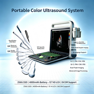 Sistema de Ultrasonido Profesional HD 3D 4D de 15 Pulgadas con Función Doppler PW CW para Aplicaciones de Cardiología - Product Image 2