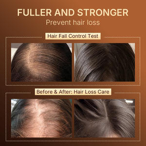 Shampooing et après-<span class=keywords><strong>shampoing</strong></span> pour la croissance des cheveux, <span class=keywords><strong>anti</strong></span>-<span class=keywords><strong>chute</strong></span>, marques privées professionnelles OEM ODM - Product Image 6