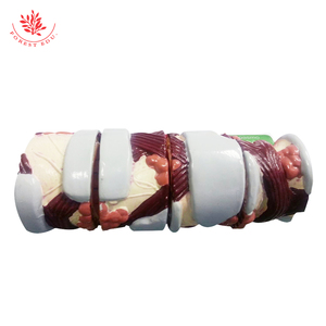 4-delige Brounchus Model Normale Zwelling Hypersecretie Spierspasmen Anatomisch Model - Product Image 4