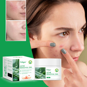 Crema Hidratante de <span class=keywords><strong>Aloe</strong></span> <span class=keywords><strong>Vera</strong></span> Natural Zaleyae, Desvanece Manchas, Antiacné, Reduce Poros, Nutre, Repara, Rejuvenece, Gel para el Cuidado Facial - Product Image 1