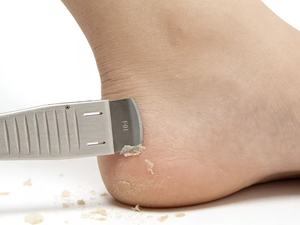 Set Professionale di Strumenti per Pedicure, Attrezzi per Unghie Incarnite, Tronchesine in Acciaio Inox, <span class=keywords><strong>Tagliaunghie</strong></span>, Rimozione Cuticole - Product Image 6