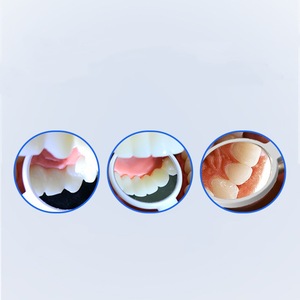 Miroir buccal LED Haishen Hainuo avec batterie intégrée, haute définition, anti-buée, pour examen dentaire - Product Image 1