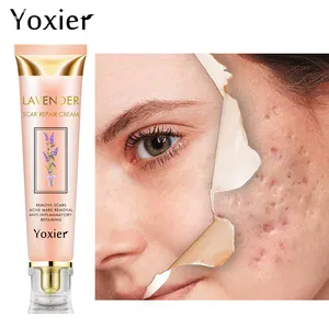 Yoxier-Tratamiento de eliminación de cicatrices, crema para eliminación de acné y marcas elásticas
