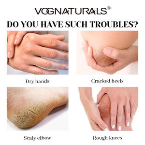 <span class=keywords><strong>Crema</strong></span> idratante per piedi e piedi rinnovata con etichetta privata - Product Image 6