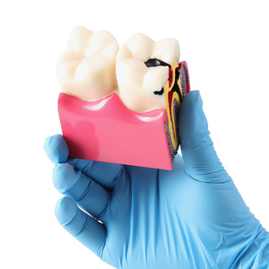 Azdent modello di insegnamento dentale 6 volte carie due lato contrasto anatomico per l'educazione del paziente e spiegazione - Product Image 4