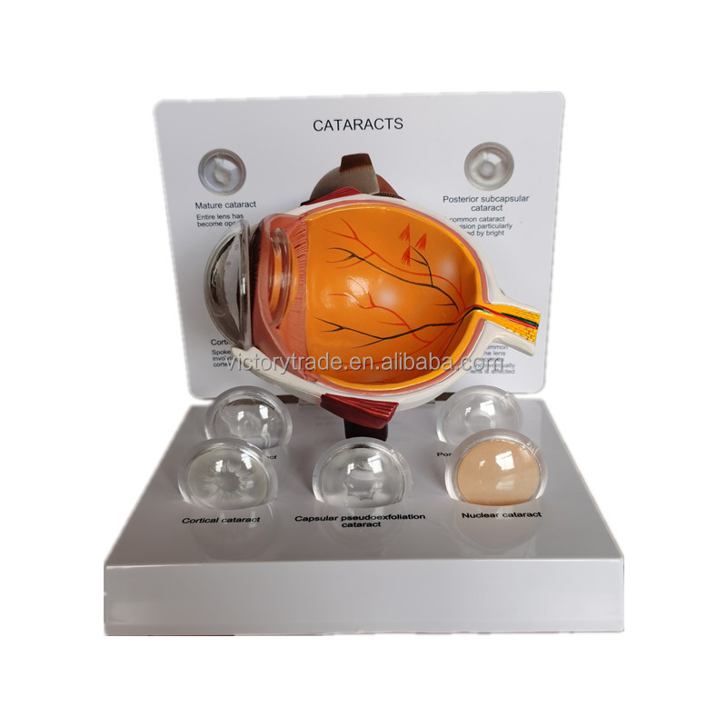 V-AM029 пластик человека 3D катаракта анатомическая модель глаза с 5 взаимозаменяемыми линзами