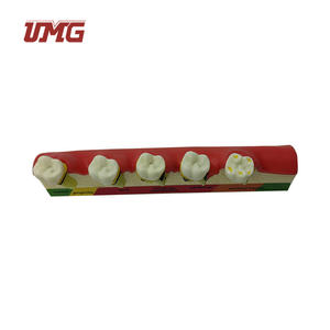 Tandheelkundige Studiemodellen Classificatiemodel Parodontitis - Product Image 5