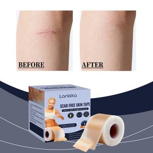 Cinta de Hidrogel Transpirable y Ligera de Grado Médico para Cuidado Postquirúrgico y Quemaduras, Tiras Curativas Ecológicas que Reducen el Enrojecimiento - Product Image 2