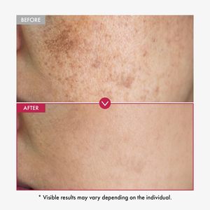 BLIW Private Label Coreano <span class=keywords><strong>Glow</strong></span> <span class=keywords><strong>Glass</strong></span> Skin Dark Spot Remoção Niacinamida 10% Ácido Tranexâmico 4% Soro Com Vitamina B12 Arbutin - Product Image 3