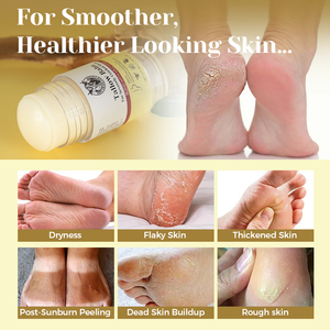 <span class=keywords><strong>Crema</strong></span> <span class=keywords><strong>per</strong></span> <span class=keywords><strong>Piedi</strong></span> all'Ingrosso con Cera d'Api <span class=keywords><strong>per</strong></span> Rimuovere la Pelle Morta e i Calli, Stick <span class=keywords><strong>per</strong></span> la Cura dei <span class=keywords><strong>Piedi</strong></span>, Riparazione Talloni Screpolati, Sego di Manzo Montato <span class=keywords><strong>per</strong></span> <span class=keywords><strong>Piedi</strong></span> Secchi - Product Image 2