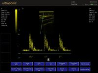 Appareil d'échographie portable noir et blanc pour usage vétérinaire, écran LCD 15 pouces avec multi-sondes pour animaux de petite et grande taille, Échographe vétérinaire