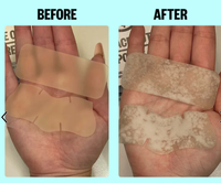 Grossiste OEM Meilleure vente de patch hydrocolloïde pour le nez autocollant hydrocolloïde pour la beauté et les soins personnels