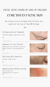 Güzellik salonları sıcak satış cilt bakımı rekombinant kollajen gözenekleri küçültmek yüz serumu - Product Image 3