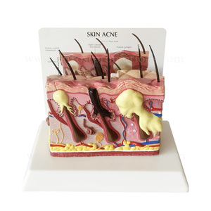 <strong>Human</strong> Anatomy <strong>Skin</strong> Acne Model - Product Image 2