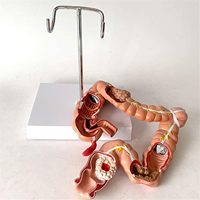 Modèle de maladie du côlon et du rectum humain KyrenMed, modèle pathologique de l'intestin grêle