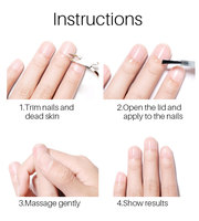 Traitement antifongique pour les ongles en plastique Lanthome, couleur violette, tue les champignons, restaure et renouvelle les ongles, protège contre la réinfection