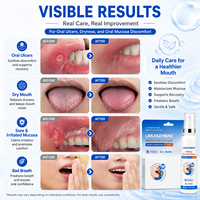 Soins bucco-dentaires, probiotiques liquides, hyaluronate de sodium, xylitol - haleine fraîche instantanée, sans alcool, sans sucre, soulage la sensibilité, répare