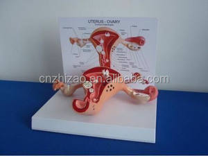 Geavanceerde pvc Vrouwelijke Interne Genitale orgel anatomisch Model - Product Image 6