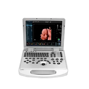 Escáner de ultrasonido portátil, sistema de diagnóstico de ultrasonido a Color
