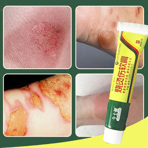 PERTOLONGAN PERTAMA Salep Perawatan Luka Bakar Anti-infeksi Salep Analgesik Herbal Tiongkok Melepuh Meredakan Nyeri Jaringan Lunak Yang Disebabkan - Product Image 3