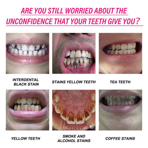 Kit di <span class=keywords><strong>sbiancamento</strong></span> con Logo personalizzato per la <span class=keywords><strong>pulizia</strong></span> <span class=keywords><strong>e</strong></span> lo <span class=keywords><strong>sbiancamento</strong></span> dei <span class=keywords><strong>denti</strong></span> con polvere di lavaggio dei <span class=keywords><strong>denti</strong></span> menta dente in polvere - Product Image 2