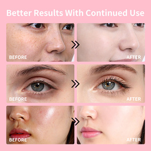 Crème hydratante pour le visage au sang de dragon en gros, adaptée à tous les types de peau, hydratante, nourrissante, rajeunissante, crème au sang de dragon - Product Image 5