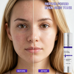 OEM Soothing Activating Regenerating Texture Improvement Acne Scar Repairing Brightening SST-50 Cica Reedle Essence <b>Face</b> <b>Serum</b> - Product Image 3