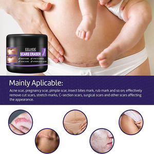 Crème de soin de la peau de haute qualité 50g Bestseller Crème réparatrice post-partum Crème anti-cicatrices - Product Image 5