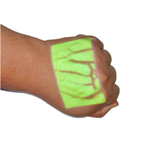 סורק ורידים רפואי באור אינפרא אדום, מכשיר לאיתור ורידים רפואי, איתור ורידים - Product Image 4