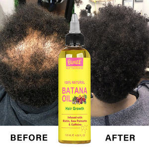 Best-seller Batana bio Shampooing <span class=keywords><strong>anti</strong></span>-<span class=keywords><strong>chute</strong></span> Huile de batana végétalienne <span class=keywords><strong>Traitement</strong></span> capillaire Croissance Shampooing et après-shampoing - Product Image 2
