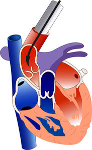 Sistema di perfusione cardiaca in vitro Langendorff per piccoli animali, ricerca elettrofisiologica e ricerca sulla contrazione cardiaca - Product Image 4