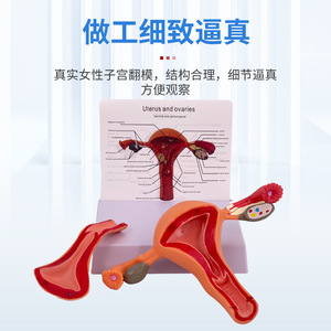 Modelo uterino femenino médico, modelo anatómico de la estructura reproductiva del ovario, modelo de anatomía ginecológica y obstétrica del ovario. - Product Image 3