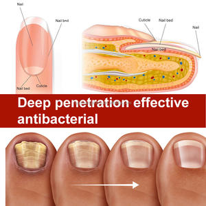 لاصقة SAMVO العشبية لإصلاح وحماية أظافر القدم من الفطريات لمدة 8 ساعات، مصنوعة من مادة الجل، نتائج سريعة وواضحة - Product Image 6